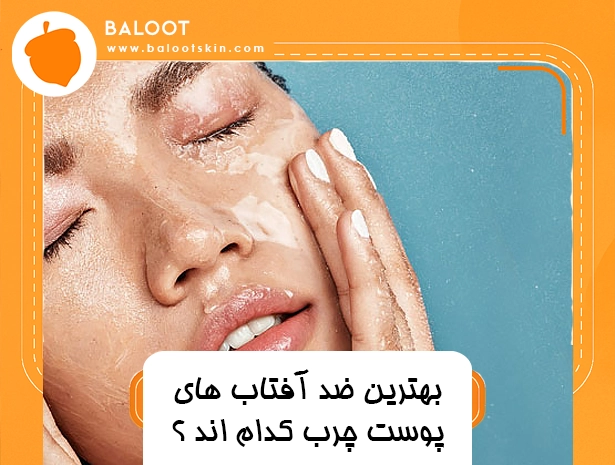 بهترین ضد آفتاب های پوست چرب کدام اند ؟