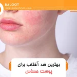 بهترین ضد آفتاب برای پوست حساس 32 بهترین ضد آفتاب برای پوست حساس