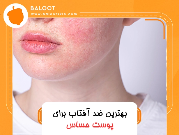 بهترین ضد آفتاب برای پوست حساس