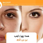 همه چیز راجب بی بی کرم 29 همه چیز راجب بی بی کرم